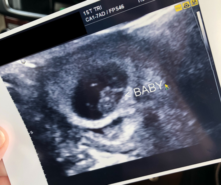 I'm Pregnant! | Blair Blogs